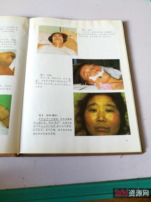 新编中医诊法图谱1995