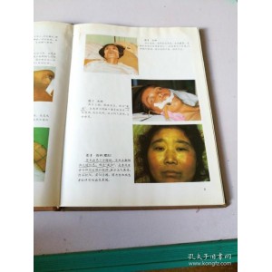 新编中医诊法图谱1995